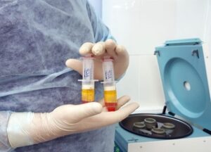 SVF и PRP терапия суставов: преимущества метода