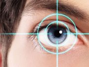 Медицинский центр «Парацельс»: коррекция зрения в Александрове