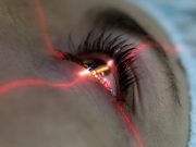 Лазерная коррекция зрения: кому показана процедура и какие преимущества она имеет