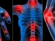 Болезни суставов: причины, диагностика, лечение