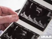 Почетный юрист РФ: платные аборты приведут к инвалидизации женщин